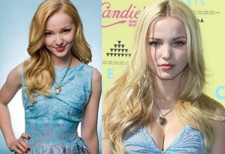 A before and after picture of Dove Cameron showing the change in her breasts size.